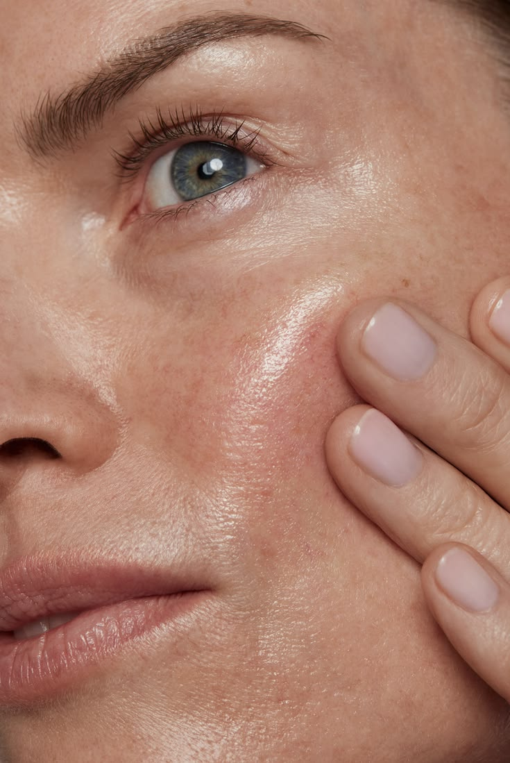 Pele opaca mesmo com skincare